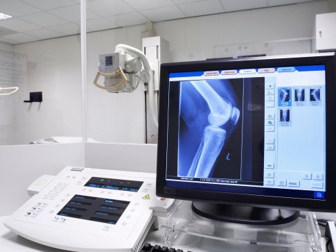Examen radiologique de l'appareil ostéo-articulaire à Brest